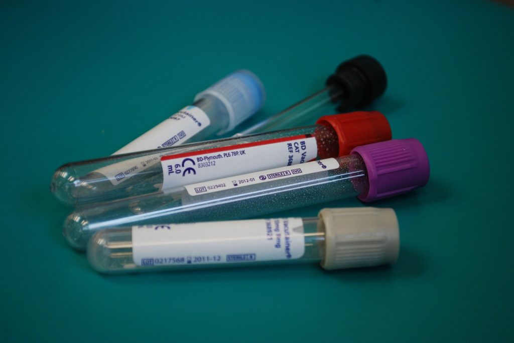 medical sample tubes. Changes to the NHS make securing compensation increasingly complex.